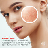 Anti-Red Ultra Sensitiv Serum